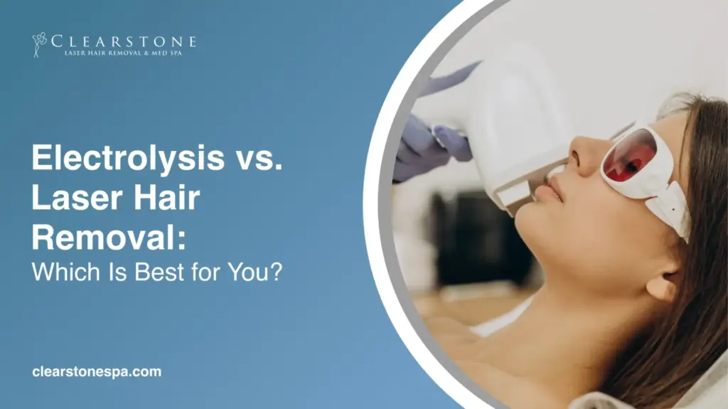 Electrolysis vs Laser Hair Removal