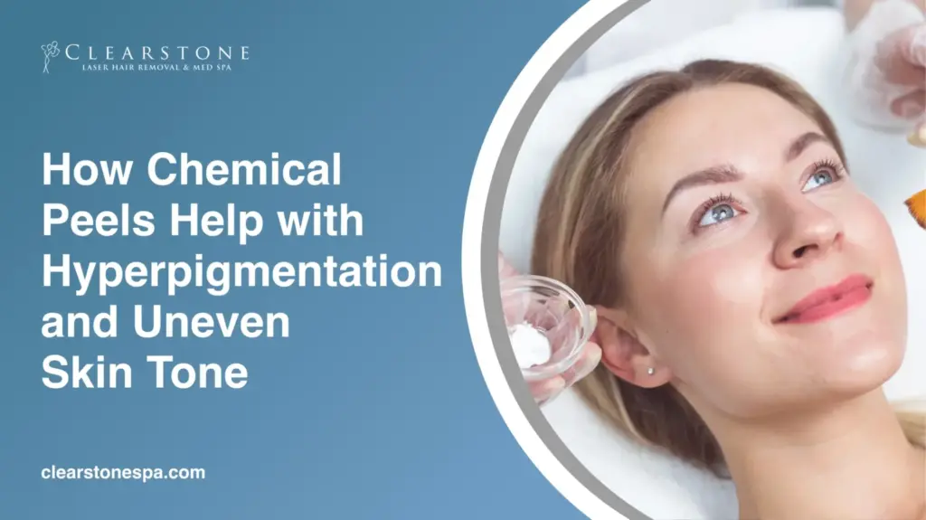 Chemical Peels