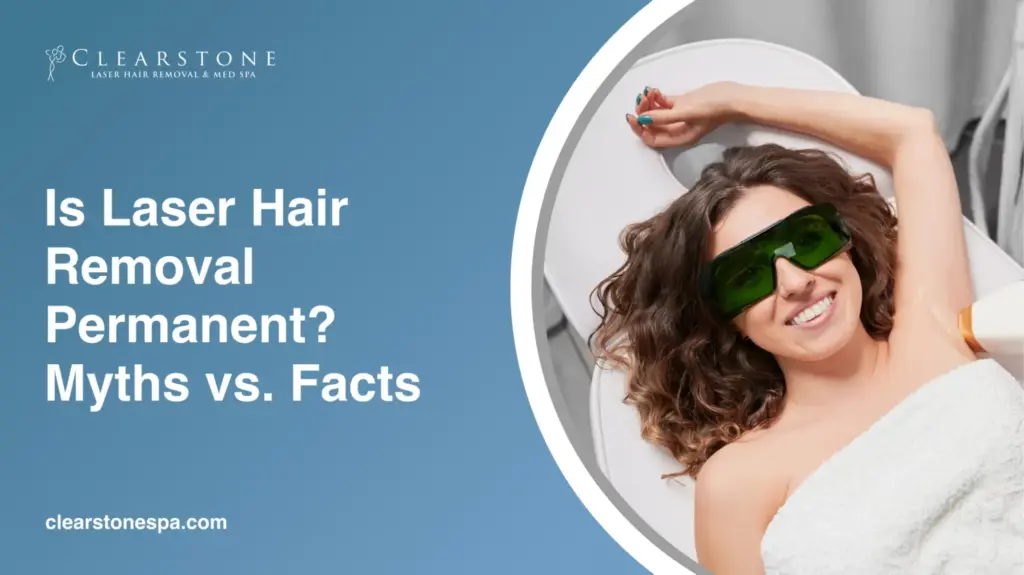 Laser Hair Removal Permanent
