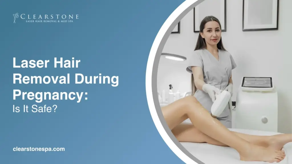 Laser Hair Removal During Pregnancy