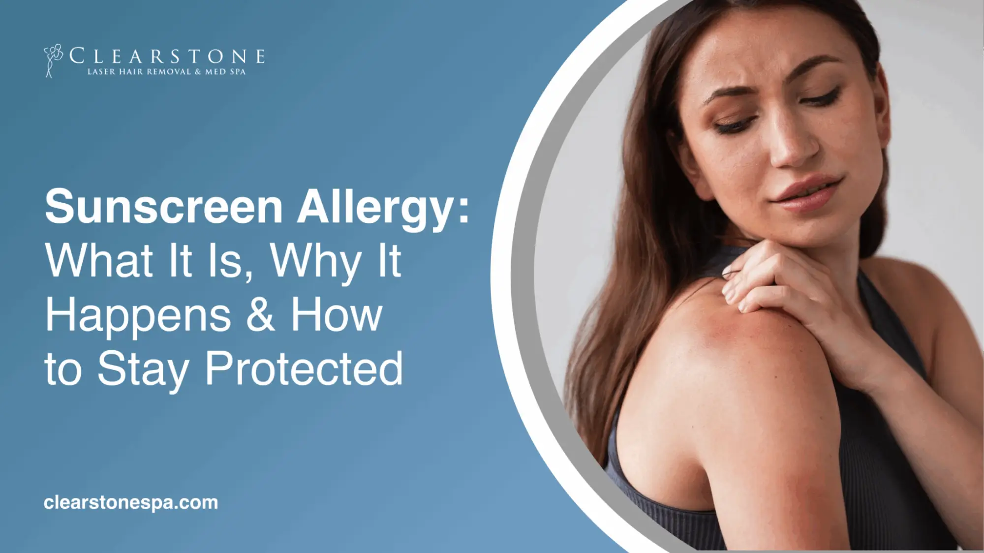 Sunscreen Allergy