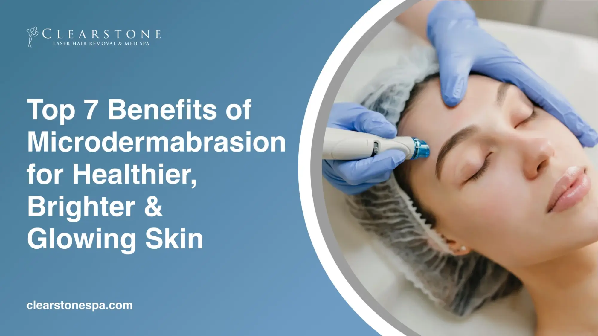 Benefits of Microdermabrasion