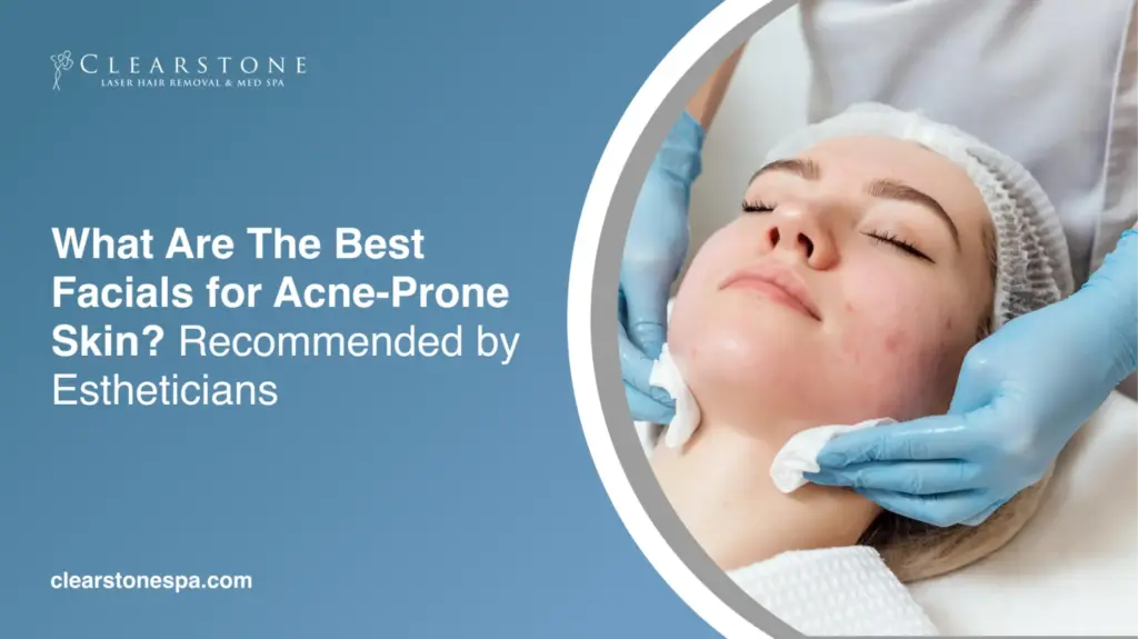 Best Facials for Acne Prone