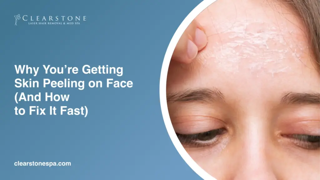 Skin Peeling